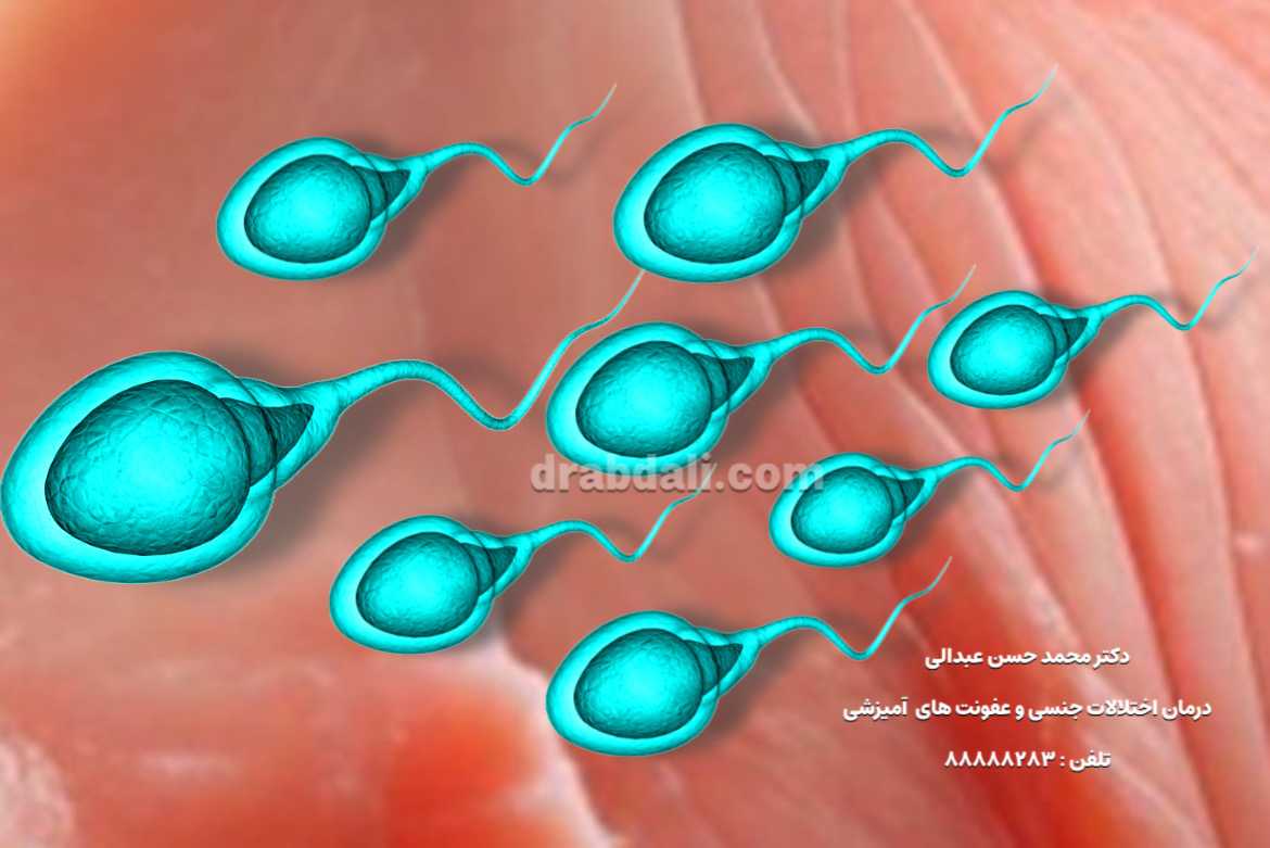 راهنمای جامع تقویت اسپرم