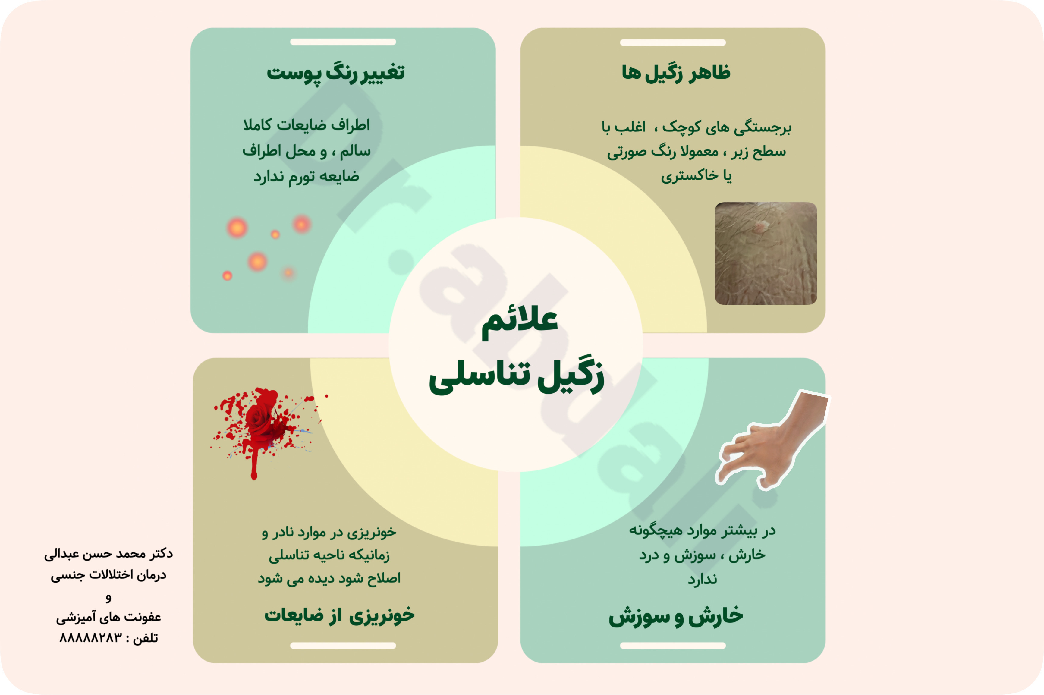 اینفوگرافی علائم زگیل تناسلی