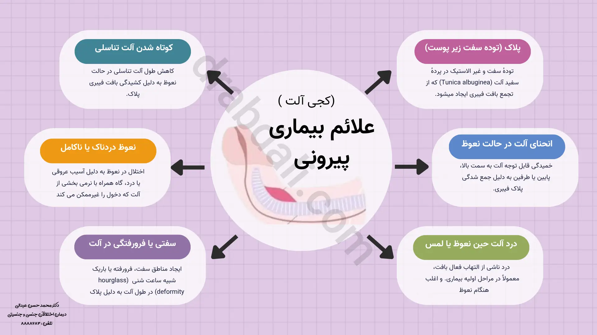 اینفوگرافی علایم بیماری پیرونی